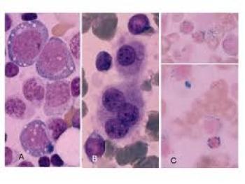 Hematoloji nedir?