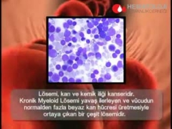 Kronik Myeloid